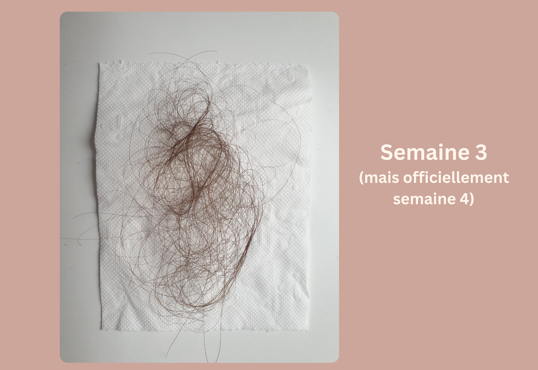 Progression de la chute de cheveux saisonnière pendant la troisième semaine