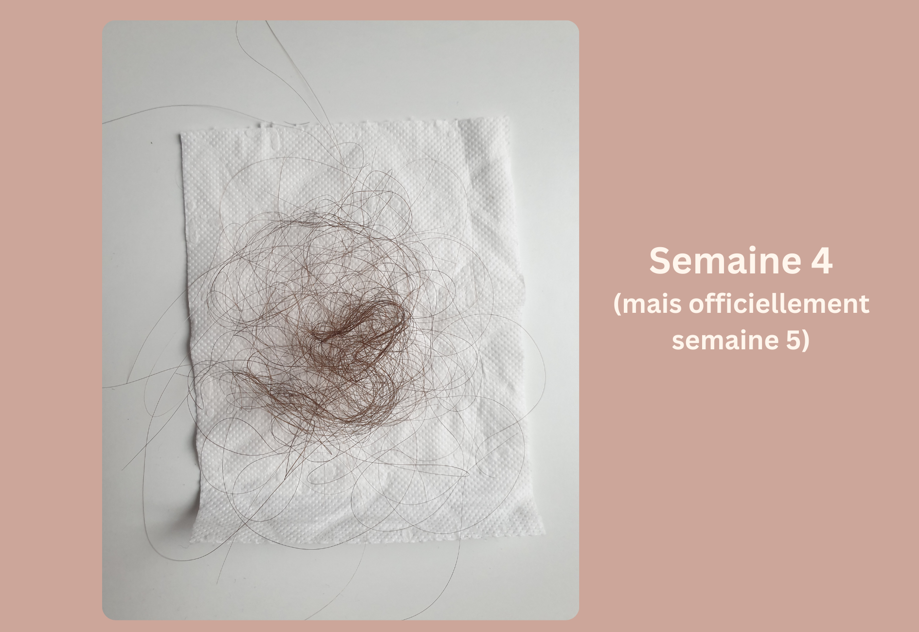 Progression de la chute de cheveux saisonnière pendant la quatrième semaine