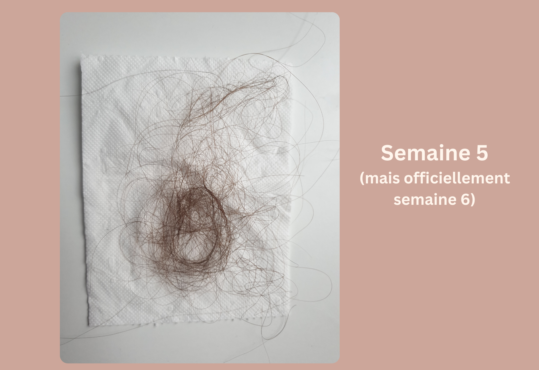 Progression de la chute de cheveux saisonnière pendant la cinquième semaine