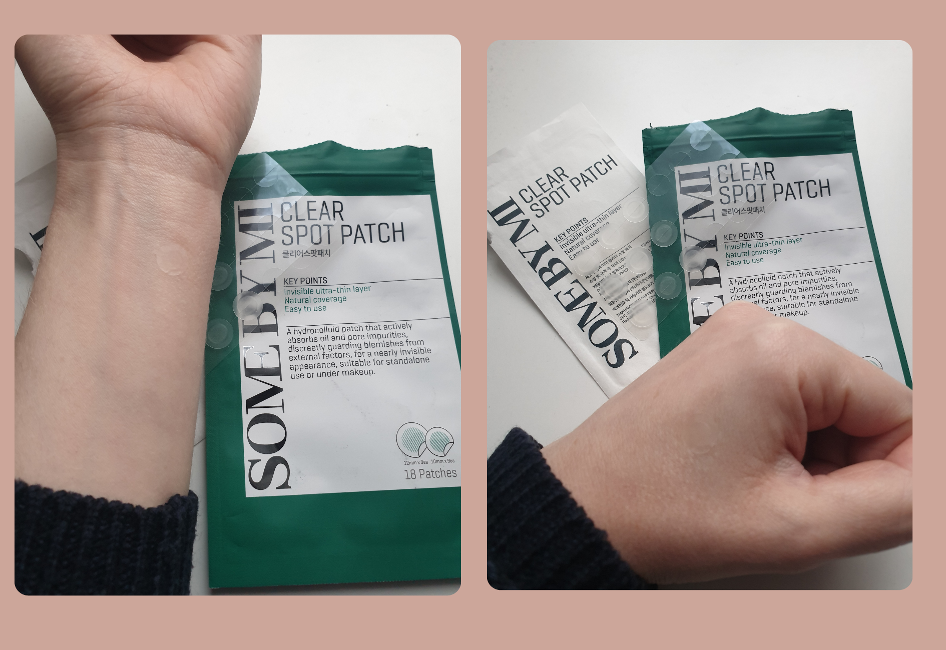 Patch anti-acné SOME BY MI sur mon bras pour montrer son apparence sur la peau